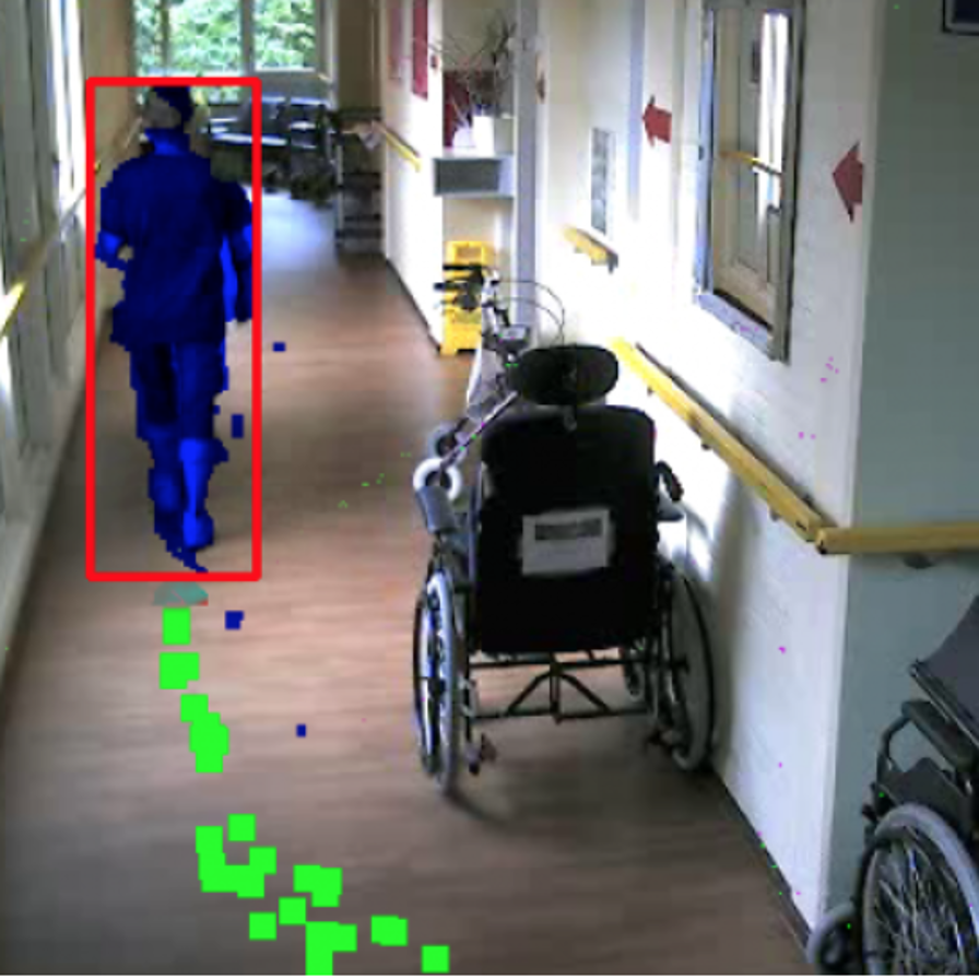 HVA BRAVO patient valrisico borgtechnologie scan